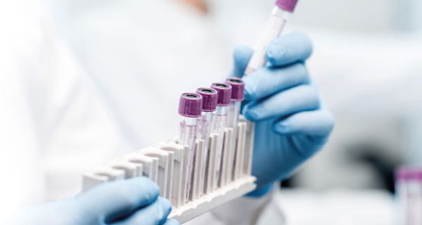 DESTAQUE_SITE_CMP_LAB_HMC_FSFX