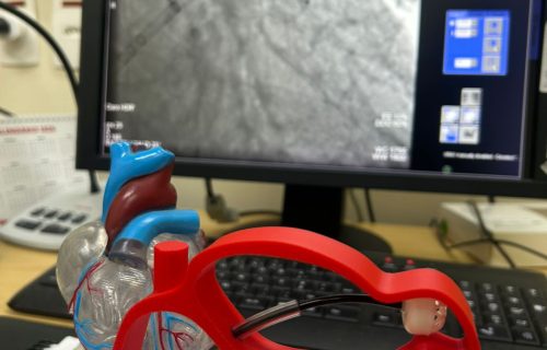 HMC REALIZA PROCEDIMENTOS INÉDITOS E AVANÇA EM INOVAÇÃO NA HEMODINÂMICA (4)