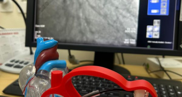 HMC REALIZA PROCEDIMENTOS INÉDITOS E AVANÇA EM INOVAÇÃO NA HEMODINÂMICA (4)